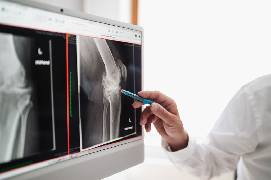 Medizinische Bilddiagnostik zur Beurteilung orthopädischer Beschwerden